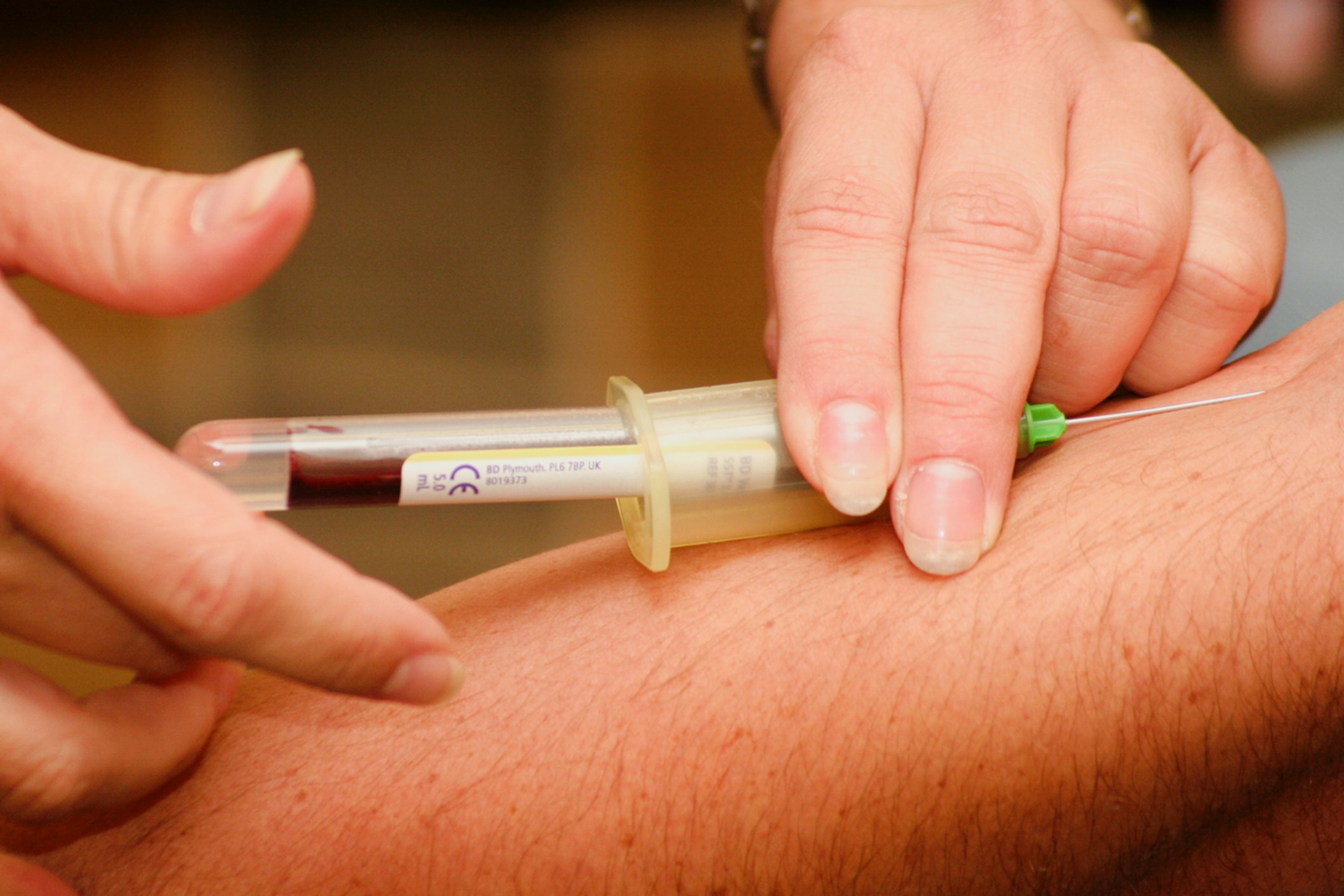 close up image of a medical professional taking blood from a patient 